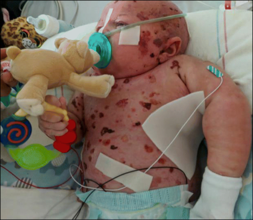 MAGG SQ 18 FLAT 100-240V 60K BC