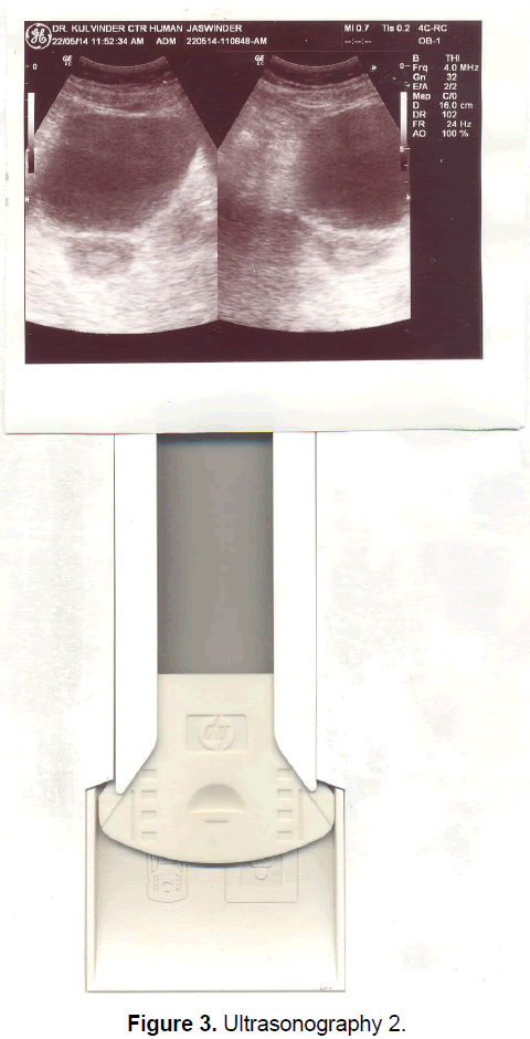 BEGHELLI LUMINARA A PRUEBA DE POLVO 2X32W T8 120-277V 4100K